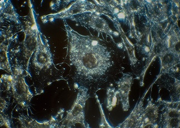 Natural killer cells: the next frontier for cancer treatment